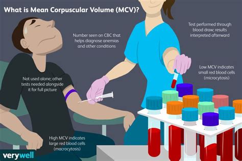 mcv bloed test - MCV (Mean Corpuscular Volume): MedlinePlus Medical Test.